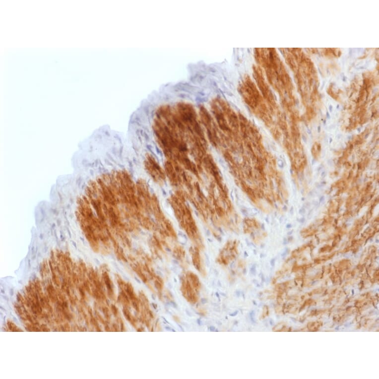 Immunohistochemistry - Anti-Calponin 1 Antibody [CNN1/1408R] (A248242) - Antibodies.com