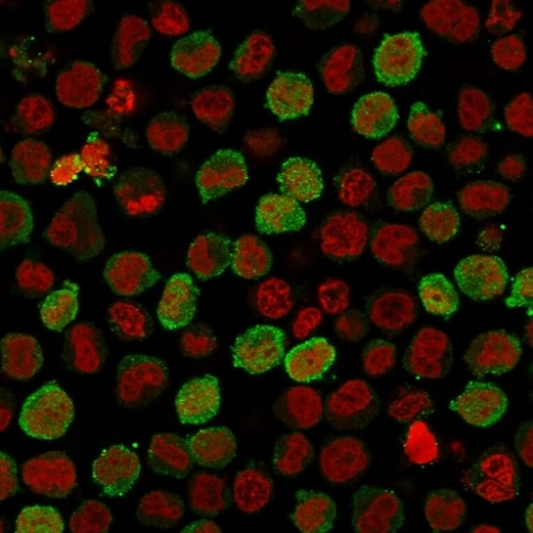 Immunofluorescence - Anti-Calponin 1 Antibody [CNN1/1408R] (A248242) - Antibodies.com