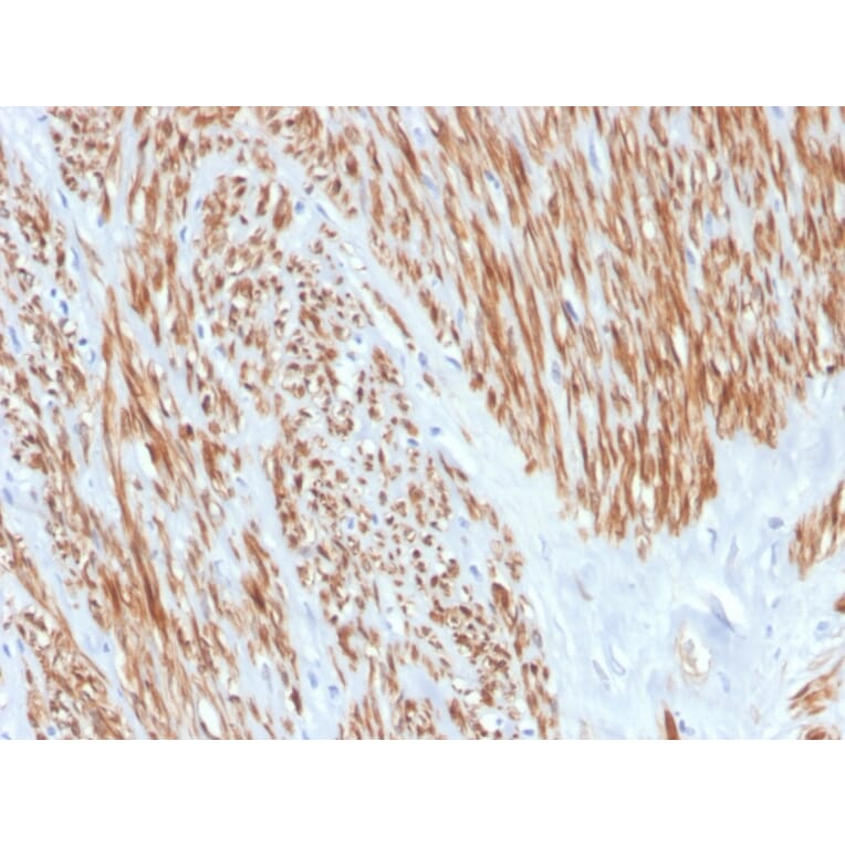 Immunohistochemistry - Anti-Calponin 1 Antibody [CNN1/4227R] (A248243) - Antibodies.com
