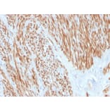 Immunohistochemistry - Anti-Calponin 1 Antibody [CNN1/4227R] (A248243) - Antibodies.com