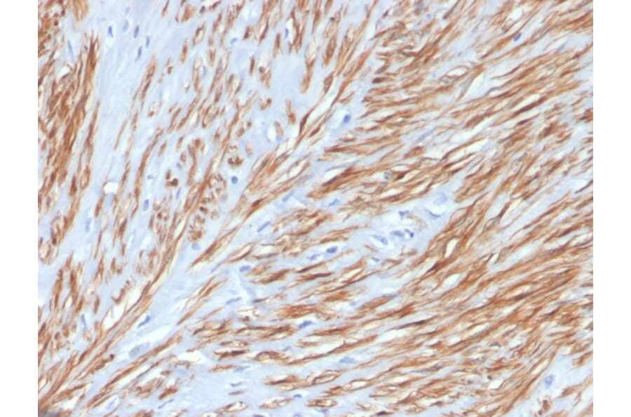 Immunohistochemistry - Anti-Calponin 1 Antibody [CNN1/4227R] (A248242) - Antibodies.com