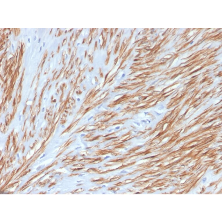 Immunohistochemistry - Anti-Calponin 1 Antibody [CNN1/4227R] (A248242) - Antibodies.com