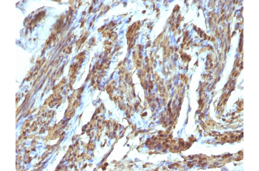 Immunohistochemistry - Anti-Calponin 1 Antibody (A248243) - Antibodies.com