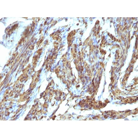 Immunohistochemistry - Anti-Calponin 1 Antibody (A248243) - Antibodies.com