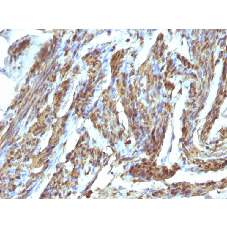 Immunohistochemistry - Anti-Calponin 1 Antibody (A248243) - Antibodies.com