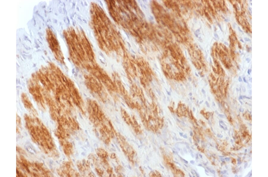 Immunohistochemistry - Anti-Calponin 1 Antibody (A248244) - Antibodies.com