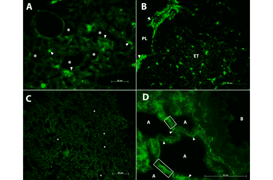 Immunofluorescence - Anti-Collagen IV Antibody [M3F7] (A248246) - Antibodies.com Citation