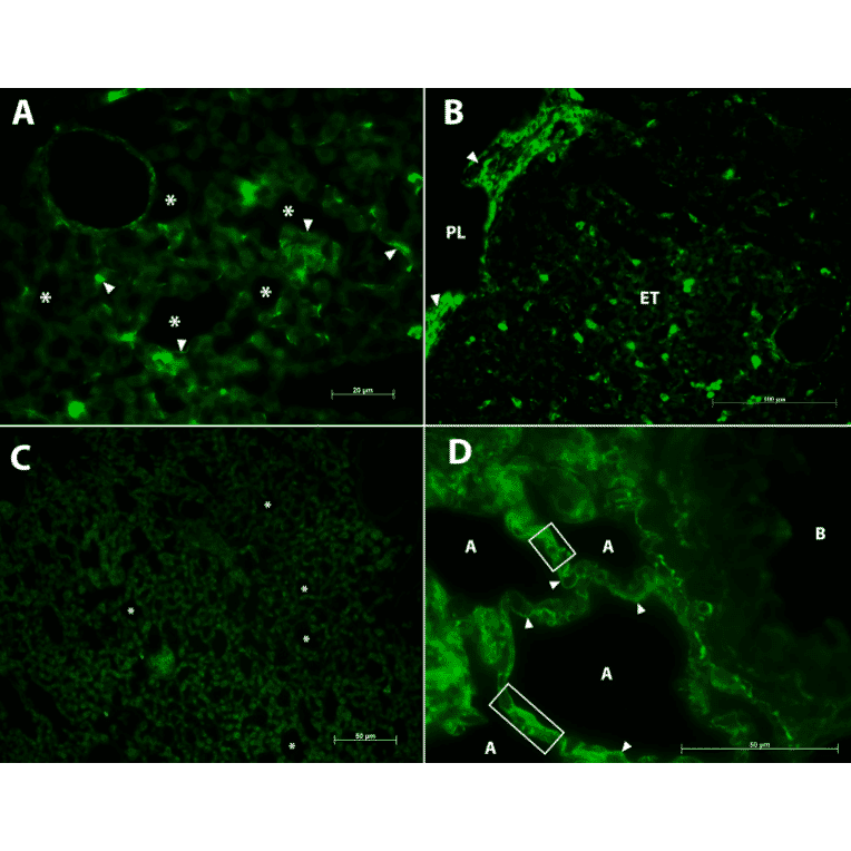 Immunofluorescence - Anti-Collagen IV Antibody [M3F7] (A248246) - Antibodies.com Citation