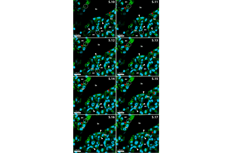 Immunofluorescence - Anti-Collagen IV Antibody [M3F7] (A248246) - Antibodies.com Citation