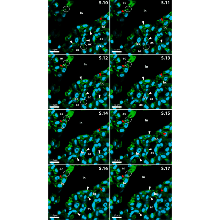 Immunofluorescence - Anti-Collagen IV Antibody [M3F7] (A248246) - Antibodies.com Citation