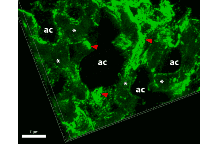 Immunofluorescence - Anti-Collagen IV Antibody [M3F7] (A248246) - Antibodies.com Citation