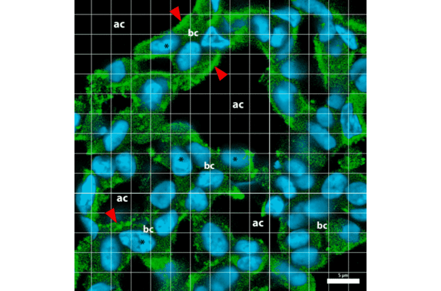 Immunofluorescence - Anti-Collagen IV Antibody [M3F7] (A248246) - Antibodies.com Citation