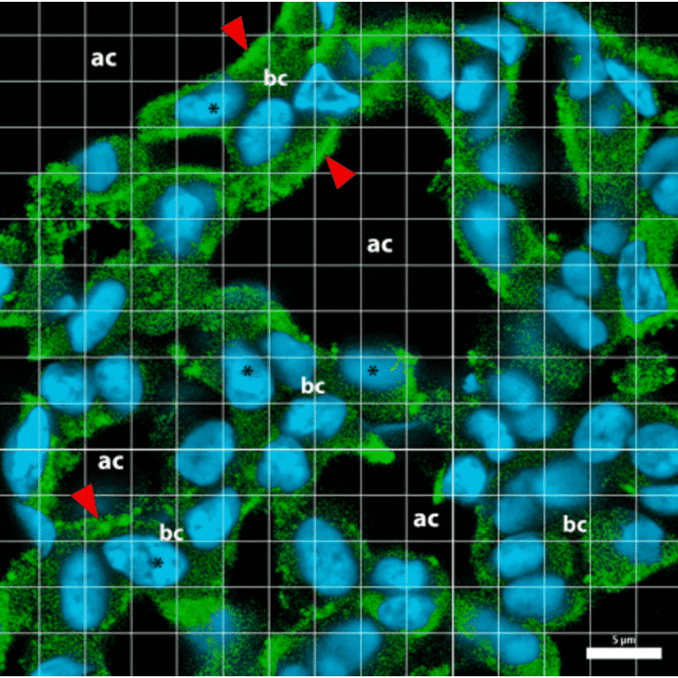 Immunofluorescence - Anti-Collagen IV Antibody [M3F7] (A248246) - Antibodies.com Citation