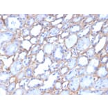 Immunohistochemistry - Anti-Collagen IV Antibody [M3F7] (A248245) - Antibodies.com