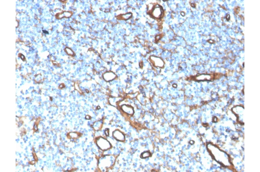 Immunohistochemistry - Anti-Collagen IV Antibody [COL4/4241R] (A248247) - Antibodies.com