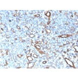 Immunohistochemistry - Anti-Collagen IV Antibody [COL4/4241R] (A248247) - Antibodies.com