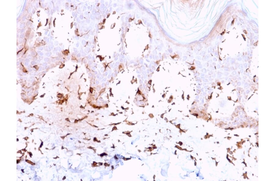Immunohistochemistry - Anti-Collagen VII Antibody [LH7.2] (A248248) - Antibodies.com
