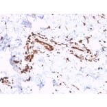 Immunohistochemistry - Anti-Collagen VII Antibody [LH7.2] (A248248) - Antibodies.com