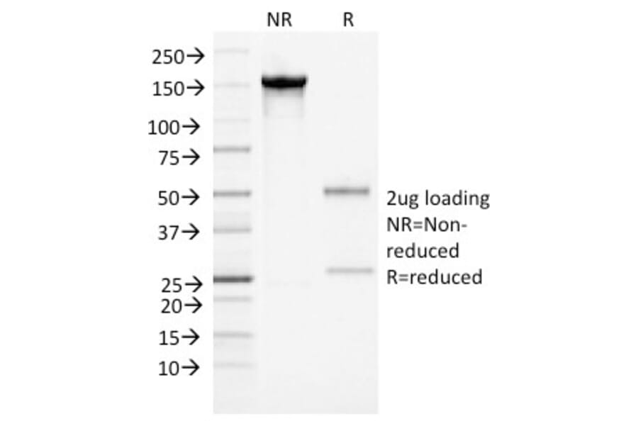 SDS-PAGE - Anti-alpha 1 Antichymotrypsin Antibody [AACT/1452] (A248250) - Antibodies.com