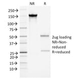 SDS-PAGE - Anti-alpha 1 Antichymotrypsin Antibody [AACT/1452] (A248250) - Antibodies.com