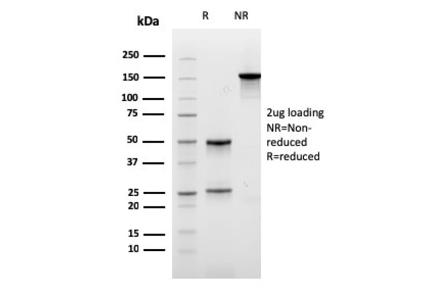 SDS-PAGE - Anti-Carboxypeptidase A1 Antibody [CPA1/2711] (A248251) - Antibodies.com