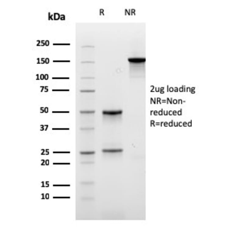SDS-PAGE - Anti-Carboxypeptidase A1 Antibody [CPA1/2711] (A248251) - Antibodies.com