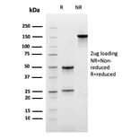 SDS-PAGE - Anti-Carboxypeptidase A1 Antibody [CPA1/2711] (A248251) - Antibodies.com