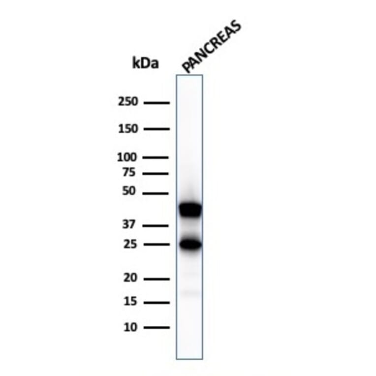 Western Blot - Anti-Carboxypeptidase A1 Antibody [CPA1/2711] (A248251) - Antibodies.com