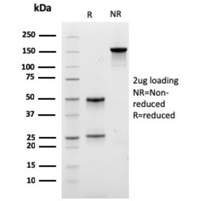 SDS-PAGE - Anti-Carboxypeptidase A1 Antibody [CPA1/2712] (A248252) - Antibodies.com
