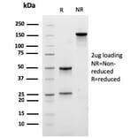 SDS-PAGE - Anti-Carboxypeptidase A1 Antibody [CPA1/2712] (A248252) - Antibodies.com