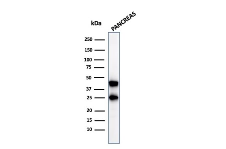 Western Blot - Anti-Carboxypeptidase A1 Antibody [CPA1/2712] (A248252) - Antibodies.com