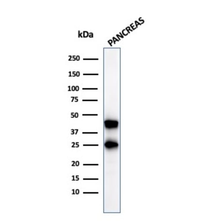 Western Blot - Anti-Carboxypeptidase A1 Antibody [CPA1/2712] (A248252) - Antibodies.com