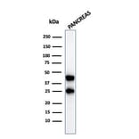 Western Blot - Anti-Carboxypeptidase A1 Antibody [CPA1/2712] (A248252) - Antibodies.com