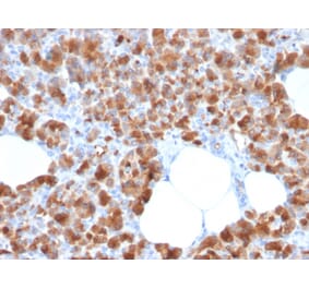 Immunohistochemistry - Anti-Carboxypeptidase A1 Antibody [CPA1/2713] (A248253) - Antibodies.com