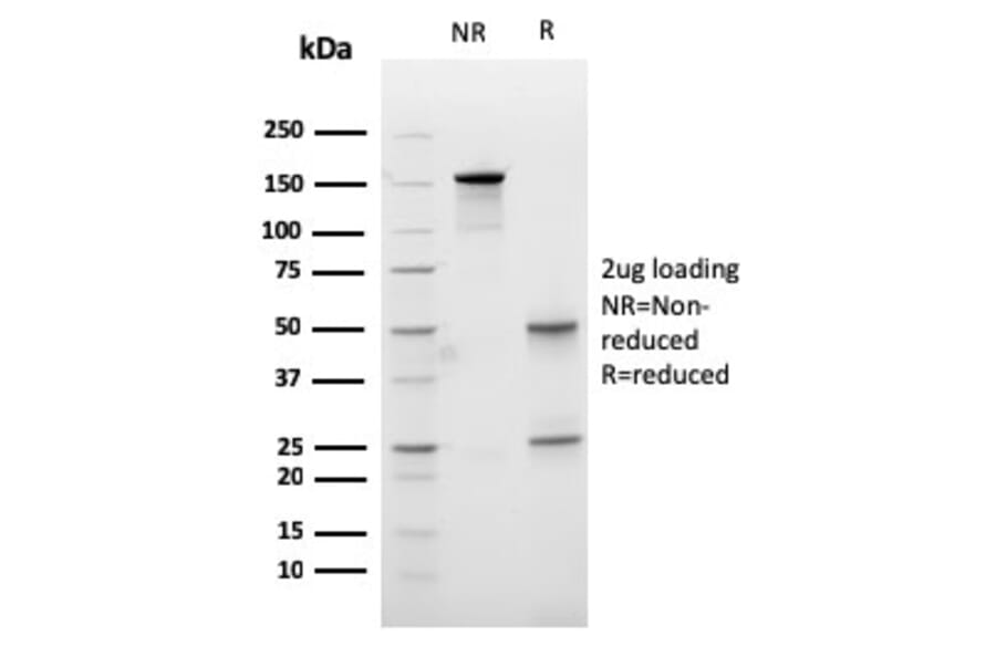 SDS-PAGE - Anti-Carboxypeptidase A1 Antibody [CPA1/2713] (A248253) - Antibodies.com