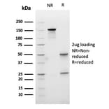 SDS-PAGE - Anti-Carboxypeptidase A1 Antibody [CPA1/2713] (A248253) - Antibodies.com