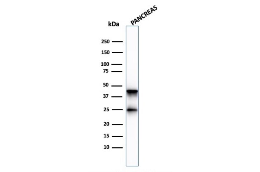 Western Blot - Anti-Carboxypeptidase A1 Antibody [CPA1/2713] (A248253) - Antibodies.com