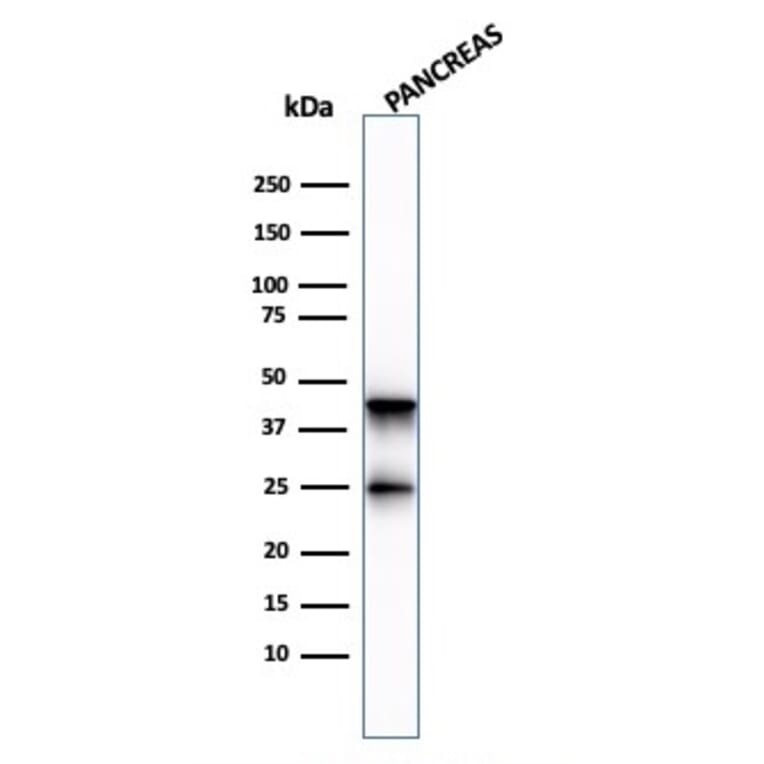 Western Blot - Anti-Carboxypeptidase A1 Antibody [CPA1/2713] (A248253) - Antibodies.com
