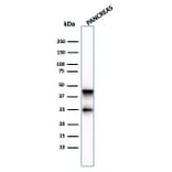 Western Blot - Anti-Carboxypeptidase A1 Antibody [CPA1/2713] (A248253) - Antibodies.com