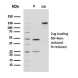 SDS-PAGE - Anti-Carboxypeptidase A1 Antibody [CPA1/2714] (A248254) - Antibodies.com
