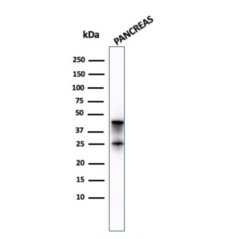 Western Blot - Anti-Carboxypeptidase A1 Antibody [CPA1/2714] (A248254) - Antibodies.com