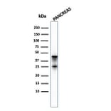 Western Blot - Anti-Carboxypeptidase A1 Antibody [CPA1/2714] (A248254) - Antibodies.com
