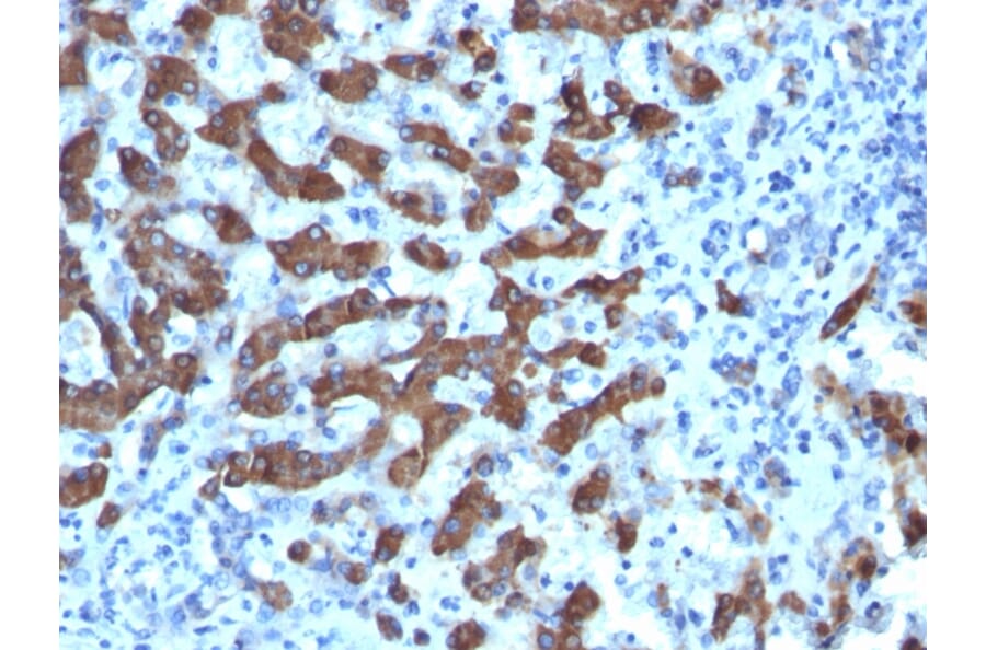 Immunohistochemistry - Anti-CPS1 Antibody [CPS1/1022] (A248254) - Antibodies.com