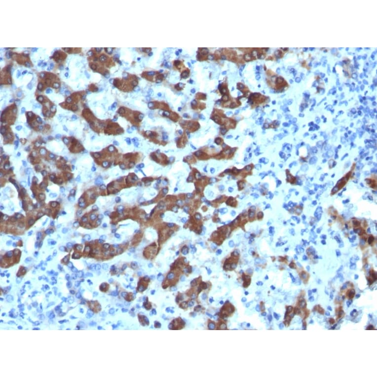 Immunohistochemistry - Anti-CPS1 Antibody [CPS1/1022] (A248254) - Antibodies.com