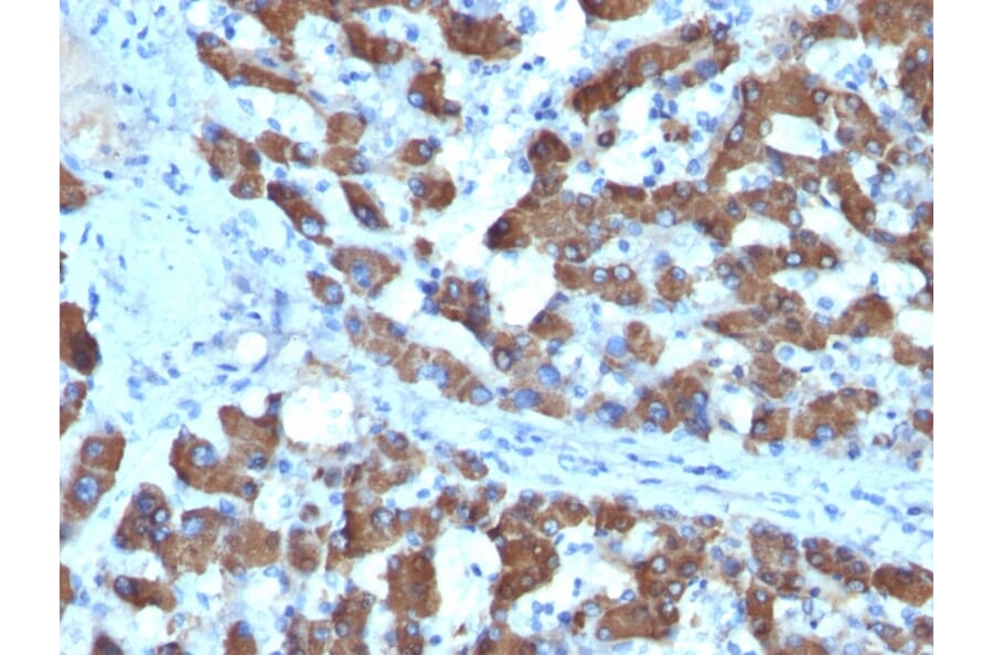 Immunohistochemistry - Anti-CPS1 Antibody [SPM615] (A248255) - Antibodies.com