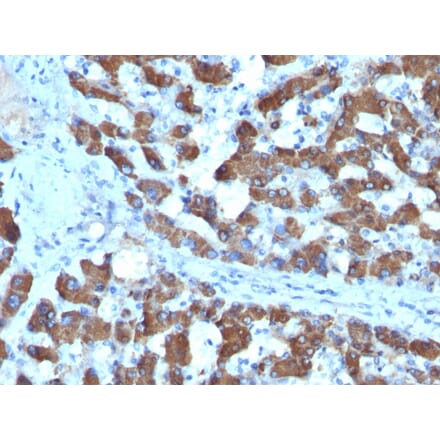 Immunohistochemistry - Anti-CPS1 Antibody [SPM615] (A248255) - Antibodies.com