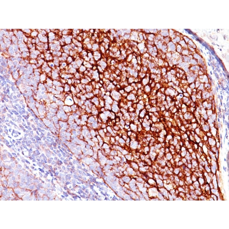 Immunohistochemistry - Anti-CD35 Antibody [E11] (A248256) - Antibodies.com