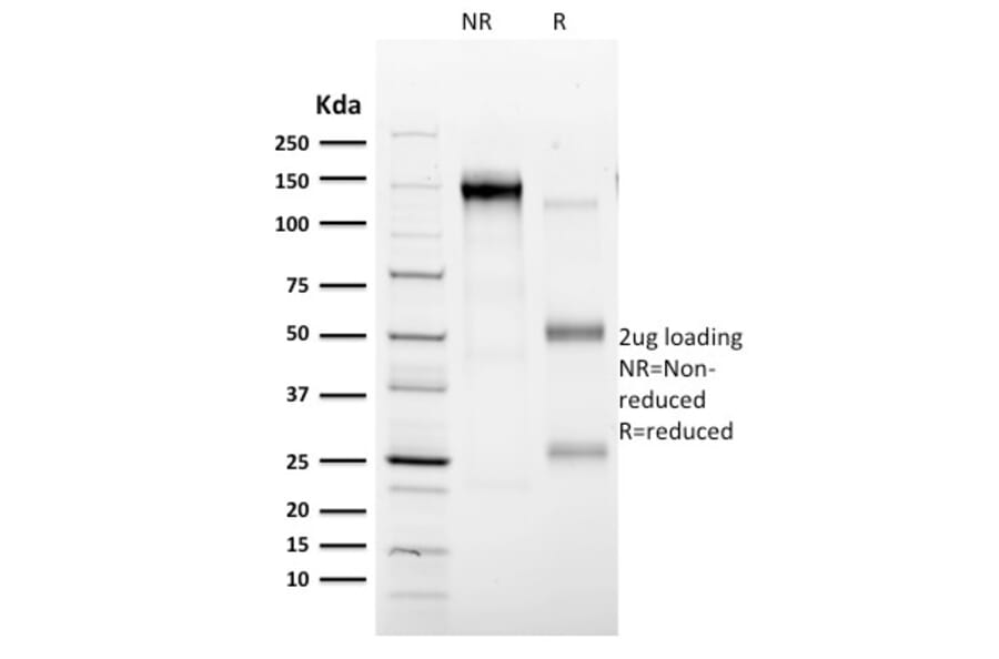 SDS-PAGE - Anti-CD35 Antibody [E11] (A248257) - Antibodies.com
