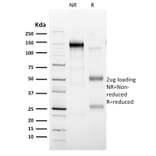 SDS-PAGE - Anti-CD35 Antibody [E11] (A248257) - Antibodies.com