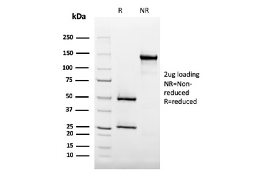 SDS-PAGE - Anti-CD35 Antibody [SPM554] (A248258) - Antibodies.com